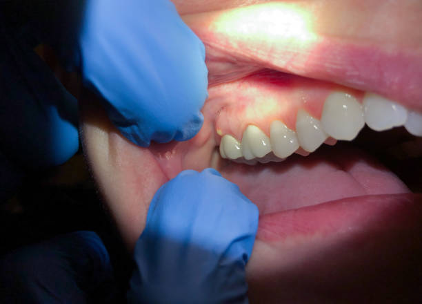 Best Emergency Treatment for Jaw Pain or Injury in Pioneer Village, KY